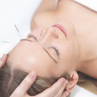 Kosmetische Akupunktur: der Ansatz der traditionellen chinesischen Medizin